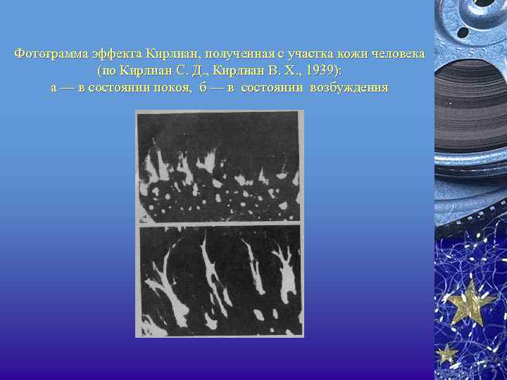 Фотограмма эффекта Кирлиан, полученная с участка кожи человека (по Кирлиан С. Д. , Кирлиан
