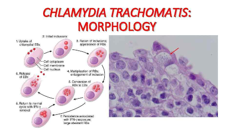 CHLAMYDIA TRACHOMATIS: MORPHOLOGY 