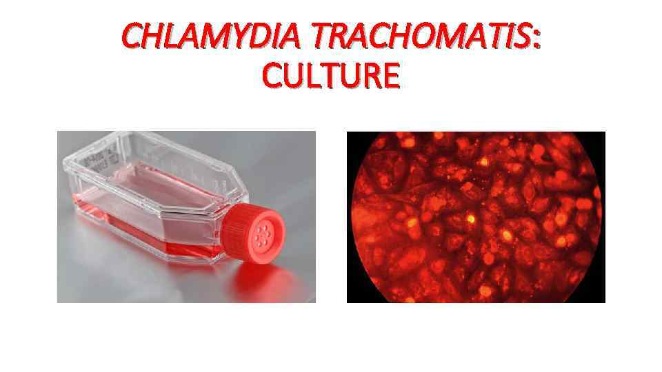 CHLAMYDIA TRACHOMATIS: CULTURE 