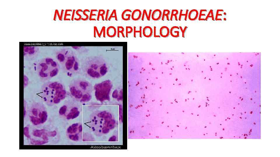 NEISSERIA GONORRHOEAE: MORPHOLOGY 