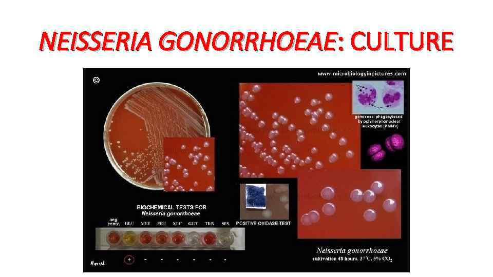 NEISSERIA GONORRHOEAE: CULTURE 