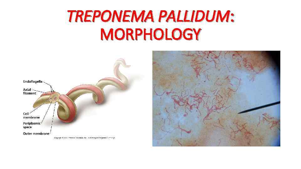 TREPONEMA PALLIDUM: MORPHOLOGY 