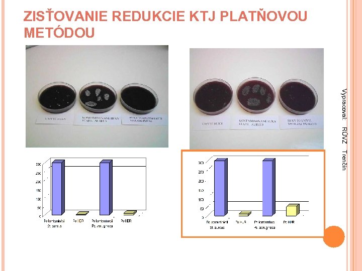 ZISŤOVANIE REDUKCIE KTJ PLATŇOVOU METÓDOU Vypracoval: RÚVZ Trenčín 