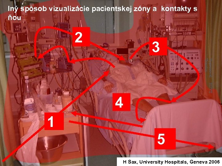 Iný spôsob vizualizácie pacientskej zóny a kontakty s ňou 2 3 Vypracoval: Trenčín RÚVZ