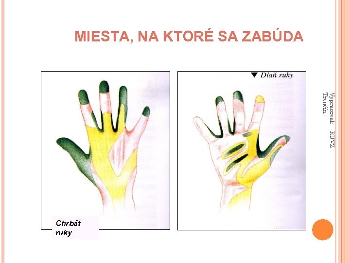 MIESTA, NA KTORÉ SA ZABÚDA Vypracoval: Trenčín RÚVZ Chrbát ruky 