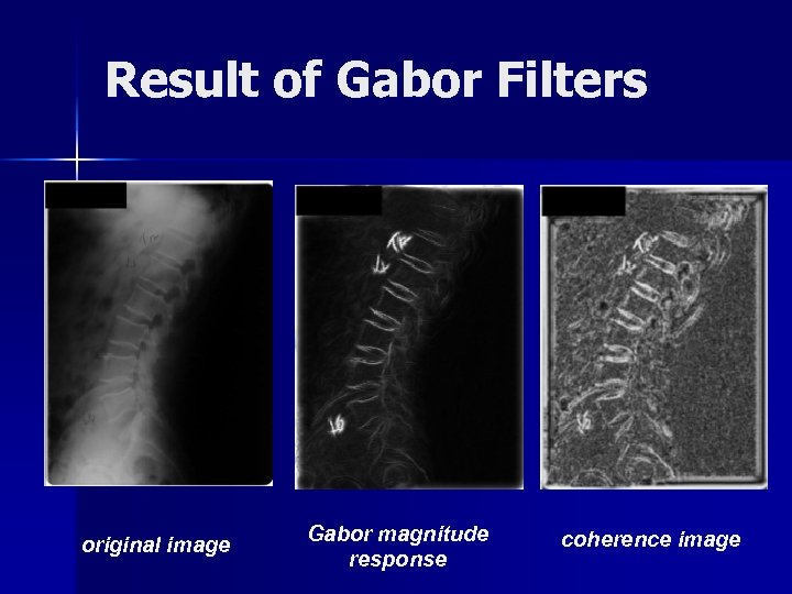 Result of Gabor Filters original image Gabor magnitude response coherence image 