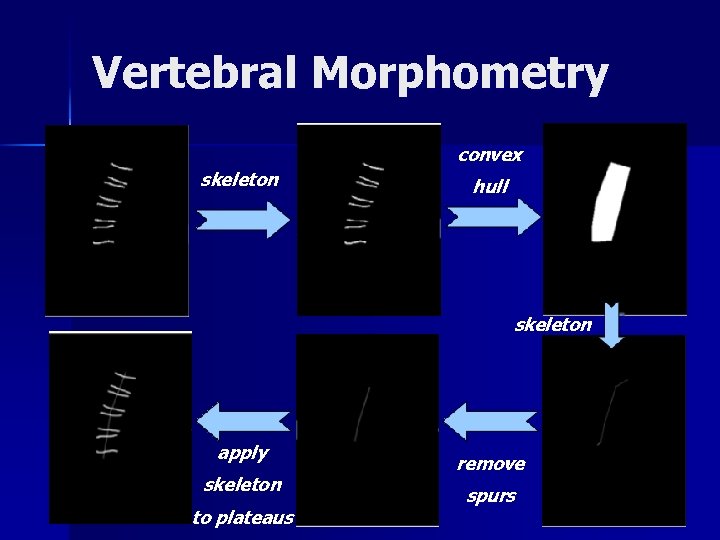 Vertebral Morphometry convex skeleton hull skeleton apply 19 skeleton to plateaus remove spurs 