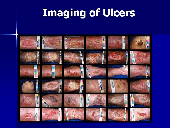 Imaging of Ulcers 32 