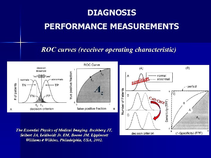 DIAGNOSIS PERFORMANCE MEASUREMENTS ROC curves (receiver operating characteristic) Az The Essential Physics of Medical