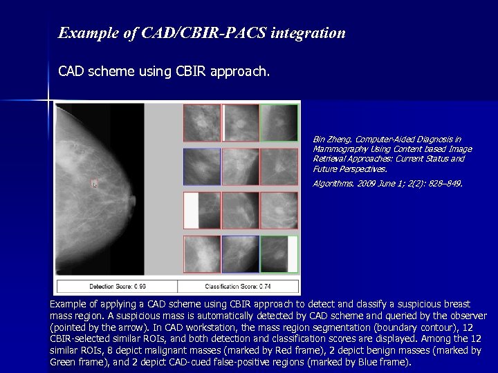 Example of CAD/CBIR-PACS integration CAD scheme using CBIR approach. Bin Zheng. Computer-Aided Diagnosis in