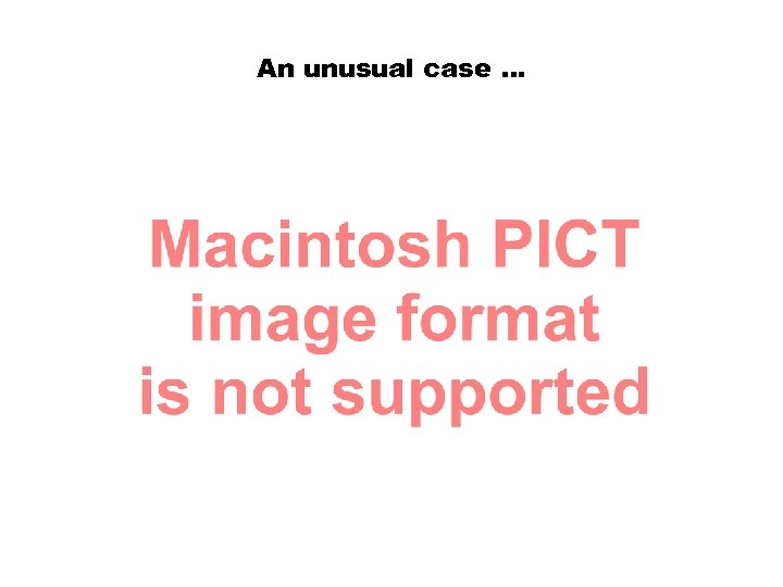 An unusual case … 