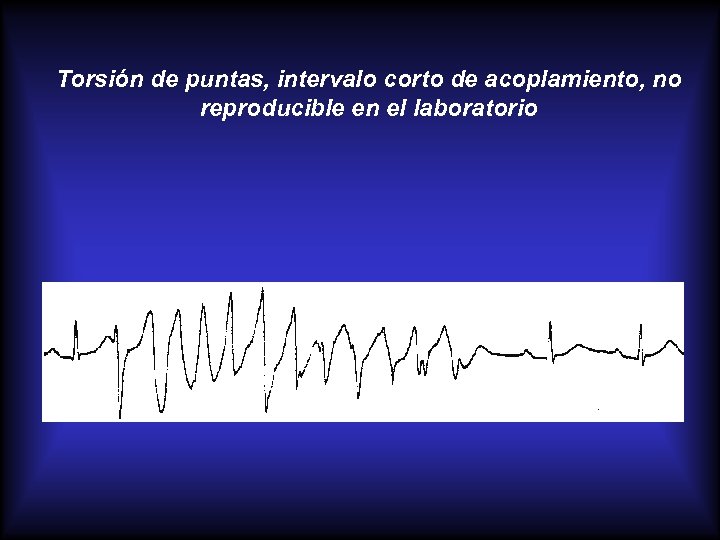 Torsión de puntas, intervalo corto de acoplamiento, no reproducible en el laboratorio 