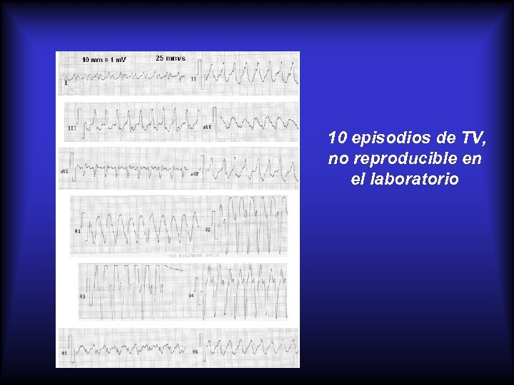 10 episodios de TV, no reproducible en el laboratorio 