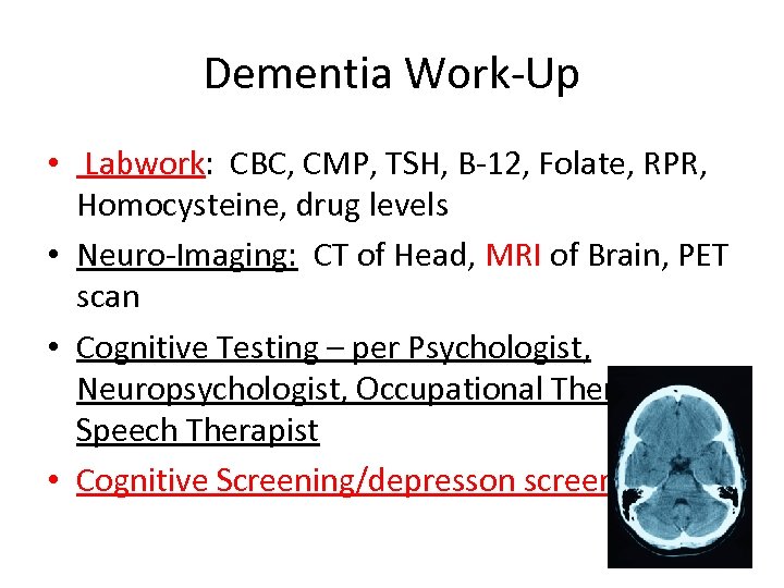 Dementia Work-Up • Labwork: CBC, CMP, TSH, B-12, Folate, RPR, Homocysteine, drug levels •