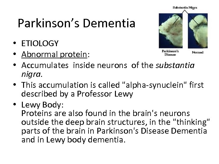 Parkinson’s Dementia • ETIOLOGY • Abnormal protein: • Accumulates inside neurons of the substantia