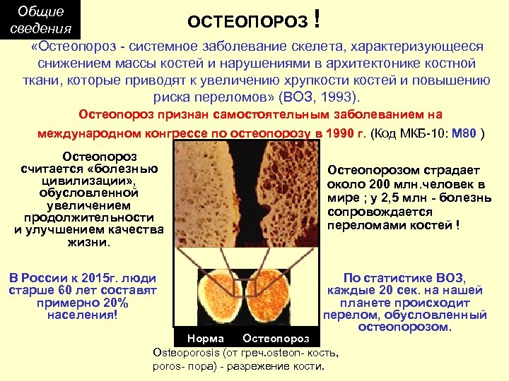 Общие ОСТЕОПОРОЗ сведения «Остеопороз - системное заболевание скелета, характеризующееся снижением массы костей и нарушениями