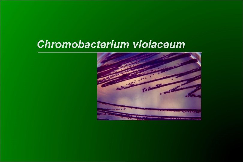 Chromobacterium violaceum 