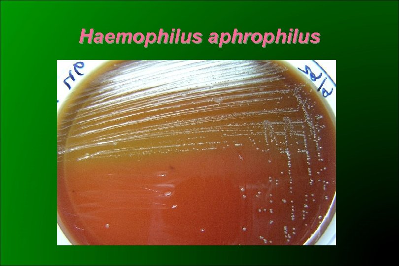 Haemophilus aphrophilus 