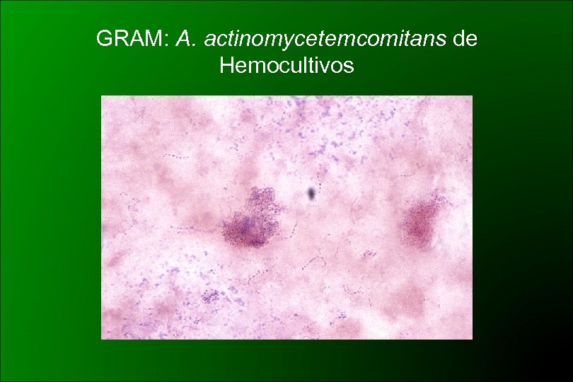 GRAM: A. actinomycetemcomitans de Hemocultivos 