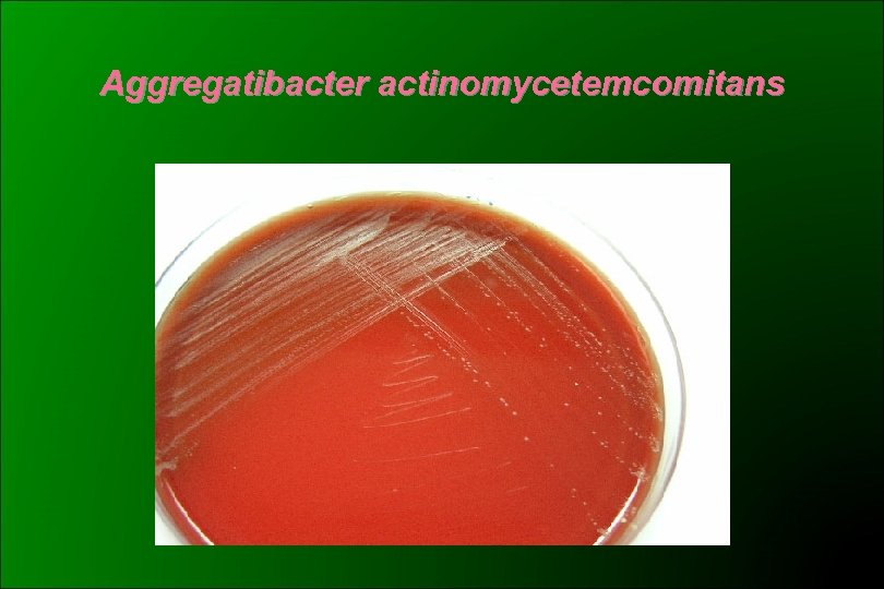 Aggregatibacter actinomycetemcomitans 