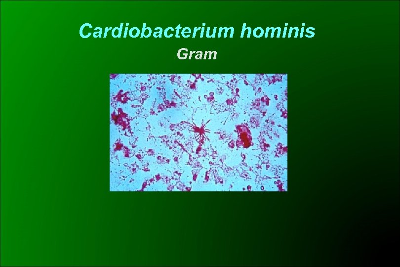 Cardiobacterium hominis Gram 