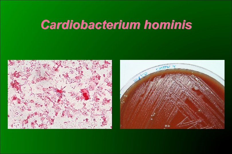 Cardiobacterium hominis 