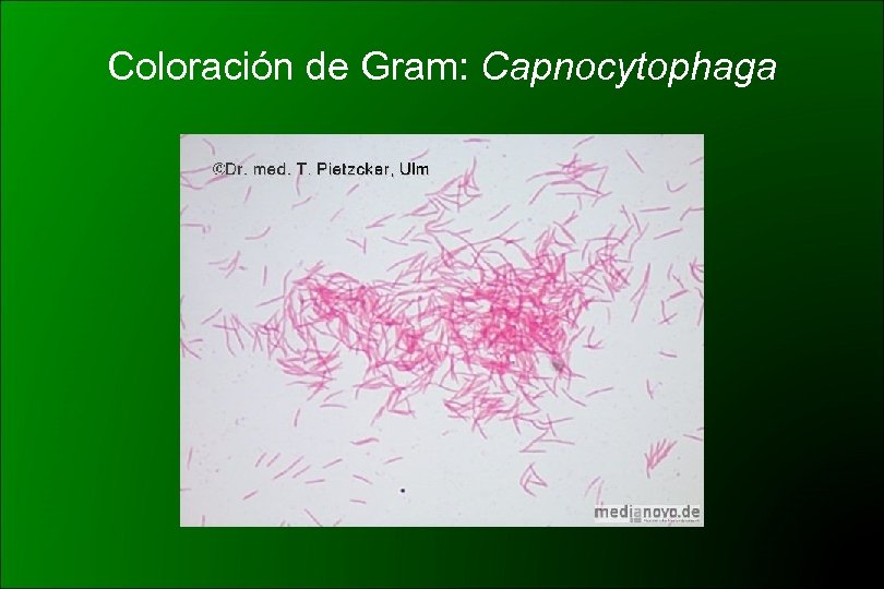 Coloración de Gram: Capnocytophaga 