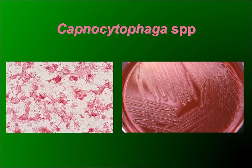 Capnocytophaga spp 