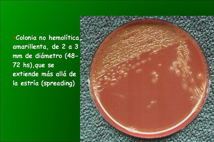 §Colonia no hemolítica, amarillenta, de 2 a 3 mm de diámetro (4872 hs), que