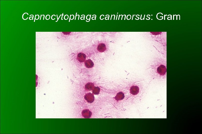 Capnocytophaga canimorsus: Gram 
