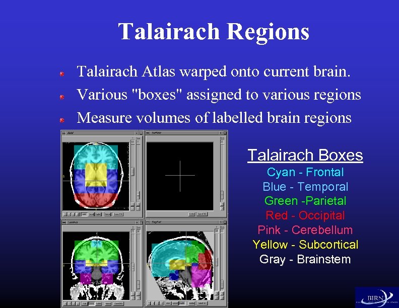 Talairach Regions Talairach Atlas warped onto current brain. Various "boxes" assigned to various regions