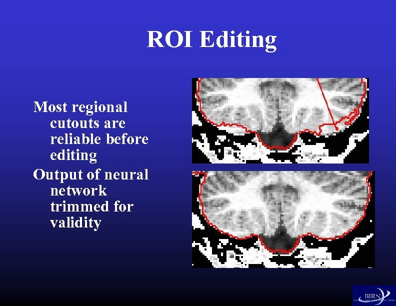 ROI Editing Most regional cutouts are reliable before editing Output of neural network trimmed