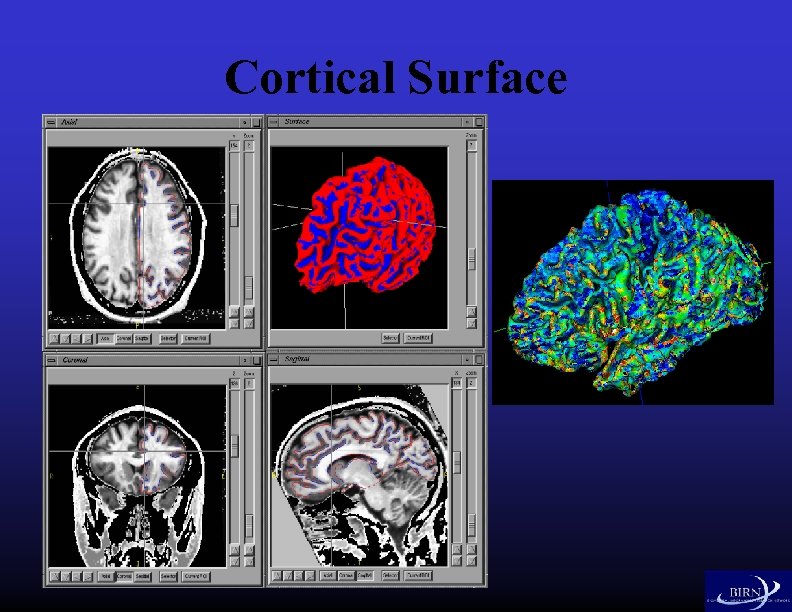 Cortical Surface 