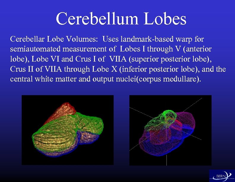 Cerebellum Lobes Cerebellar Lobe Volumes: Uses landmark-based warp for semiautomated measurement of Lobes I