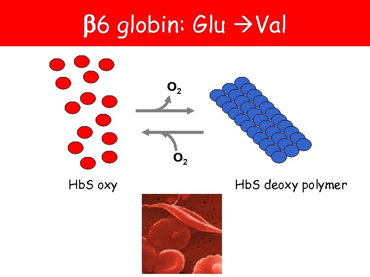 6 globin: Glu Val O 2 Hb. S oxy Hb. S deoxy polymer
