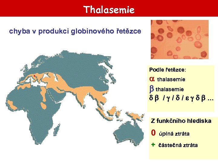 Thalasemie chyba v produkci globinového řetězce Podle řetězce: thalasemie / / / . .