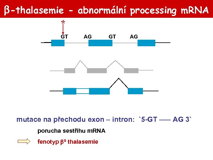 -thalasemie - abnormální processing m. RNA * GT AG mutace na přechodu exon