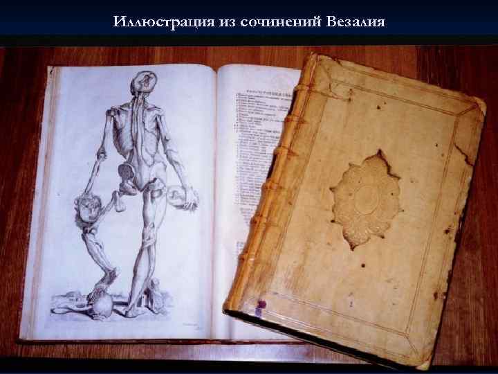 Иллюстрация из сочинений Везалия 