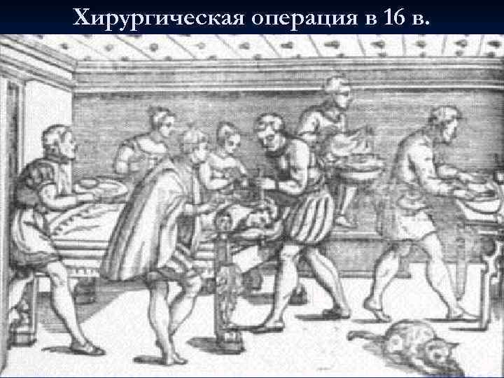 Хирургическая операция в 16 в. 