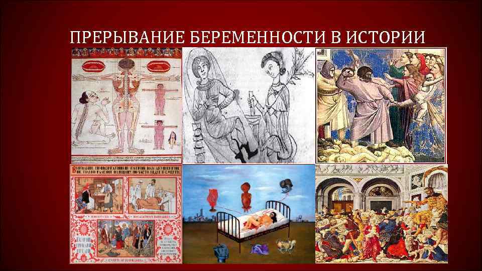 ПРЕРЫВАНИЕ БЕРЕМЕННОСТИ В ИСТОРИИ 