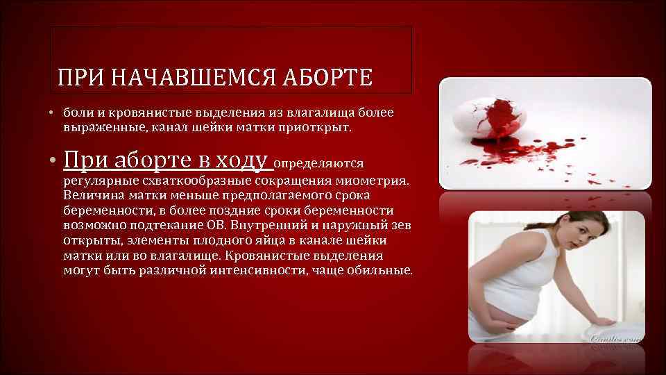 ПРИ НАЧАВШЕМСЯ АБОРТЕ • боли и кровянистые выделения из влагалища более выраженные, канал шейки