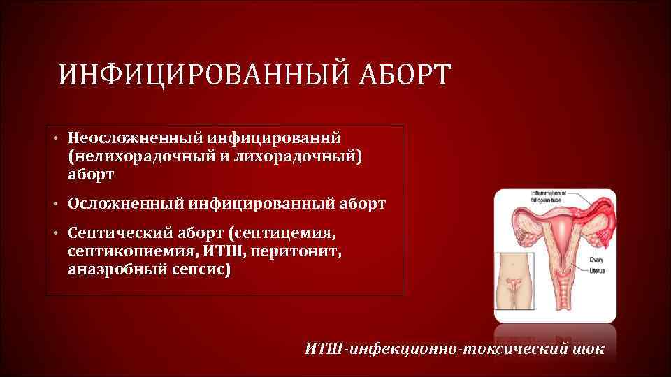 ИНФИЦИРОВАННЫЙ АБОРТ • Неосложненный инфицированнй (нелихорадочный и лихорадочный) аборт • Осложненный инфицированный аборт •
