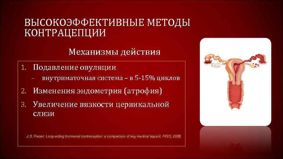 ВЫСОКОЭФФЕКТИВНЫЕ МЕТОДЫ КОНТРАЦЕПЦИИ Механизмы действия 1. Подавление овуляции – внутриматочная система – в 5