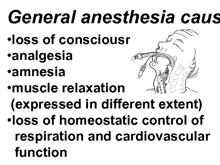 General anesthesia caus • loss of consciousness • analgesia • amnesia • muscle relaxation