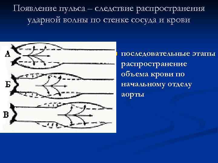 Появление пульса – следствие распространения ударной волны по стенке сосуда и крови n последовательные