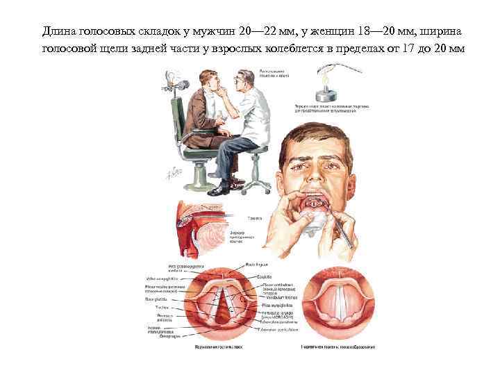 Длина голосовых складок у мужчин 20— 22 мм, у женщин 18— 20 мм, ширина