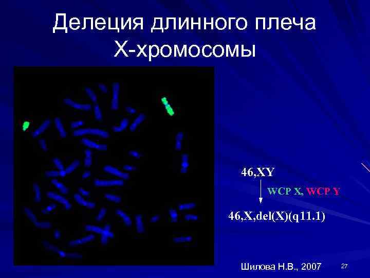 Делеция это