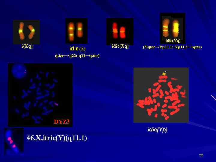 i(Xq) idic (X) (pter→q 22: : q 22→pter) idic(Xq) idic(Yq) (Yqter→Yp 11. 1: :