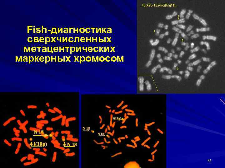 Презентация цитогенетика человека биология 10 класс