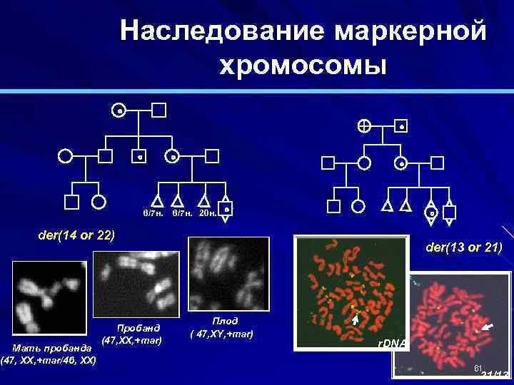 Наследование маркерной хромосомы ! ! 6/7 н. 20 н. der(14 or 22) Мать пробанда